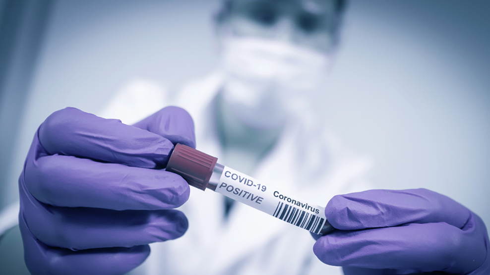 Covid-19 : तेजी से फैल रहा है कोरोना संक्रमण, 24 घंटे में 15 हजार नए केस दर्ज