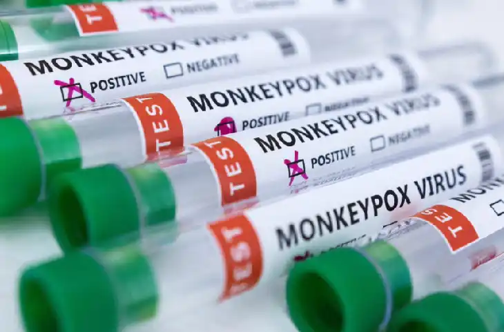Delhi में मिला Monkeypox का पहला मरीज, WHO ने घोषित किया ग्लोबल हेल्थ इमरजेंसी- इन लोगों को ज्यादा खरता