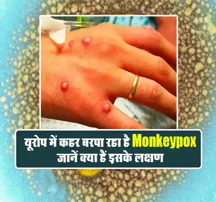 यूरोप के कई देशों में खतरनाक हुआ Monkeypox, जानिए इसके बारे में कुछ अहम बातें