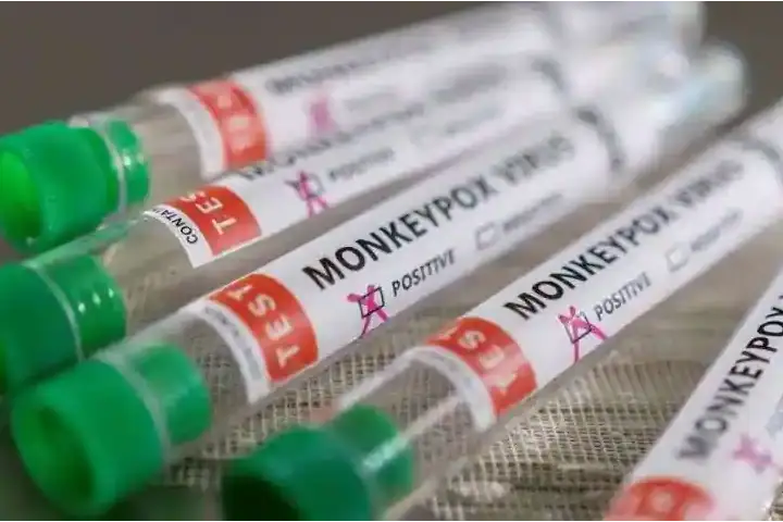 क्या अब हवा के जरिये Monkeypox Virus बनाएगा आपको अपना शिकार? लगतार बढ़ रहे मामलों के बीच WHO ने चेताया