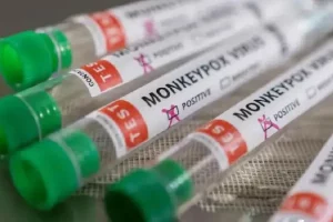 Monkeypox Update: मंकीपॉक्स से बचने के लिए क्या करें और क्या न करें ? स्वास्थ्य मंत्रालय ने जारी की एडवाइजरी