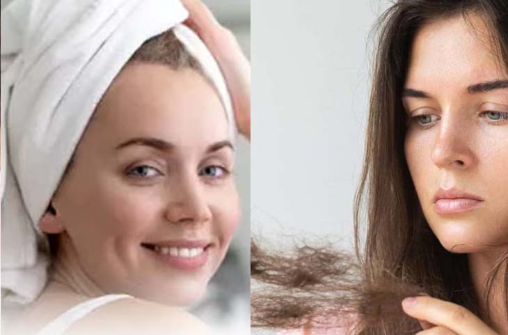 Hair Wash के बाद सिर पर तौलिया बांधना है मुसीबत को बुलावा देना, जाने खतरनाक नुकसान