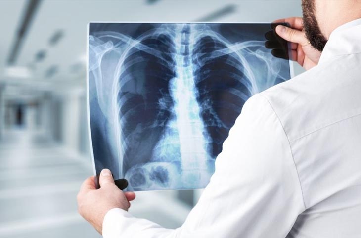 Alert: X-ray करवाने से पहले जरूर पढ़ ले ये खबर नहीं तो हो जायेंगे इस घातक बीमारी का शिकार
