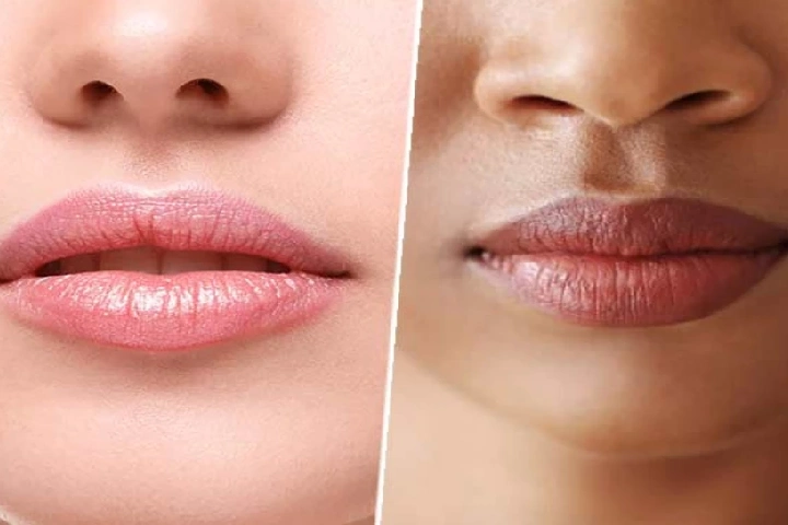Lips care tips: काले होंठों को बनाए गुलाबी और खूबसूरत, आजमाएं ये घरेलू उपाय